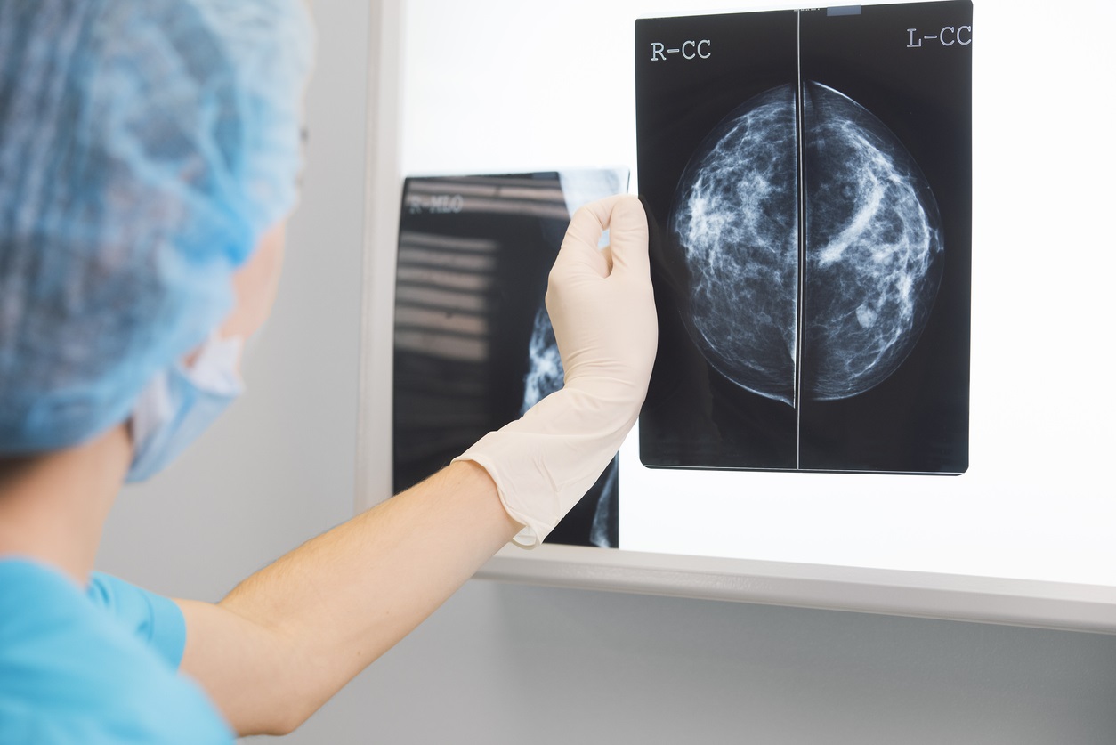  врач или медсестра в хирургическом наряде держит маммографию перед рентгеновским осветителем